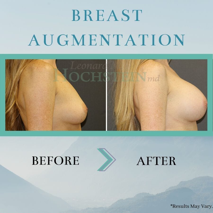 Choosing the Best Breast Implants for Your Body - LUXURGERY© NYC